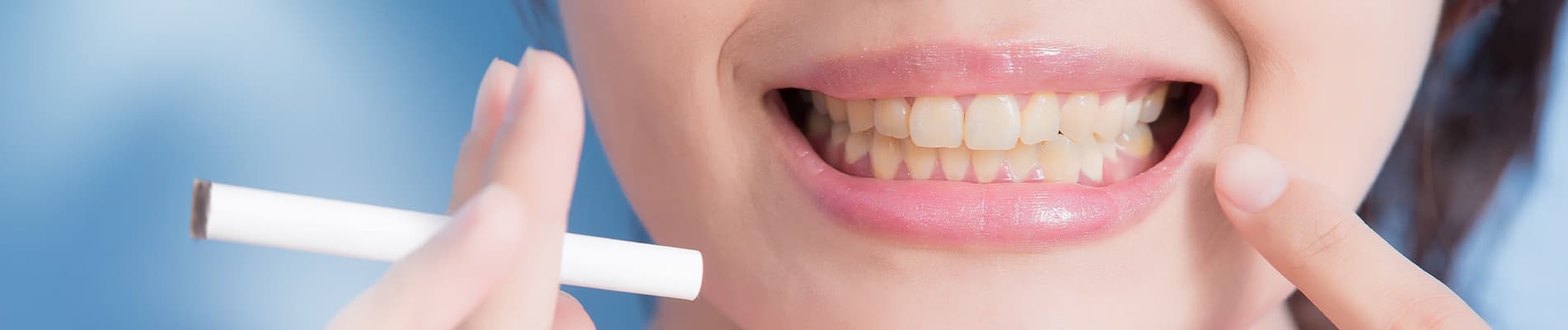 Emergency crown placement and dental recovery guide — Dental Clinic London