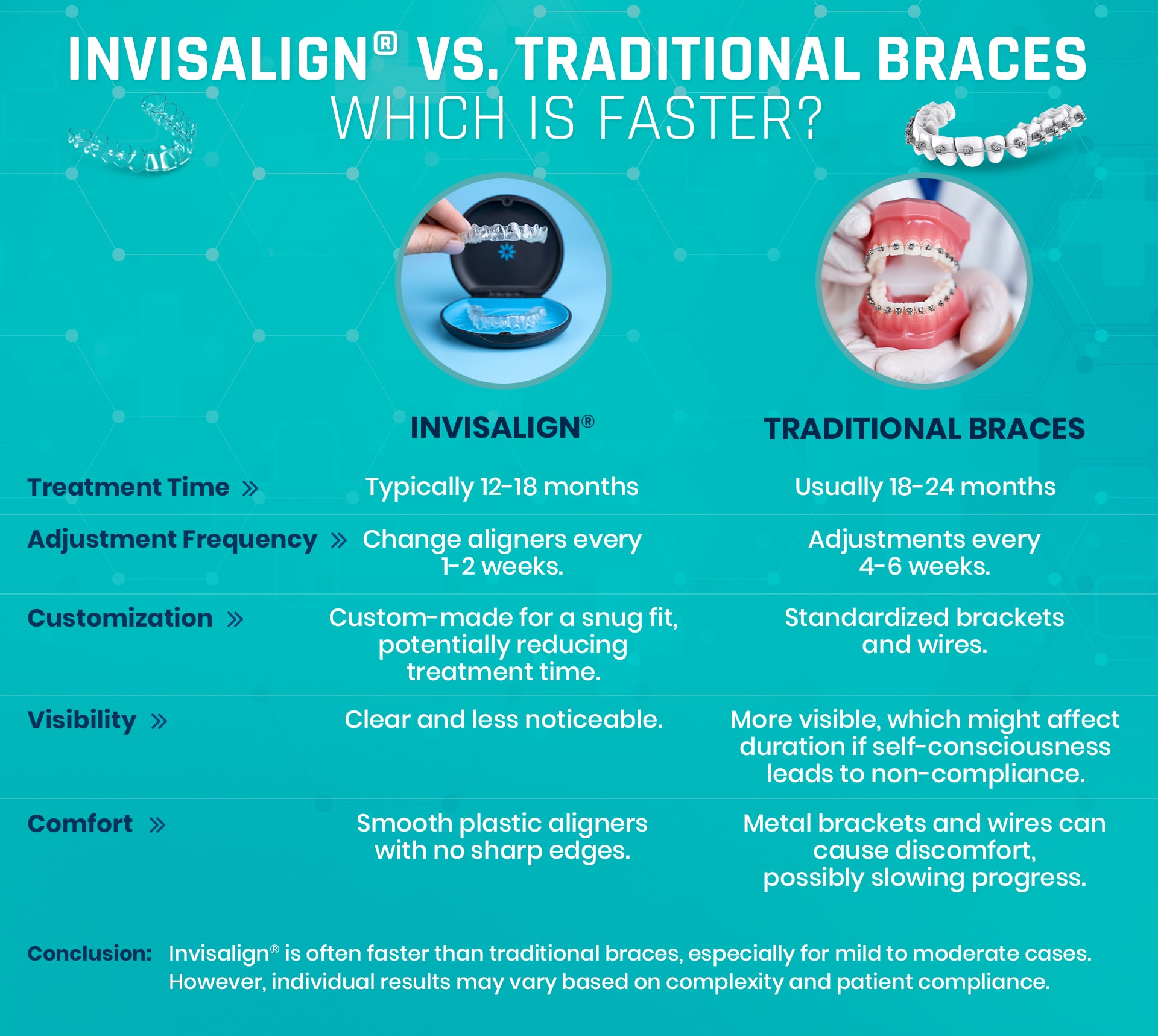 Invisalign vs Traditional Braces