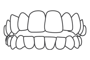 Opening Bite – Dental Clinic 