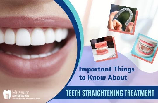 best price teeth aligners