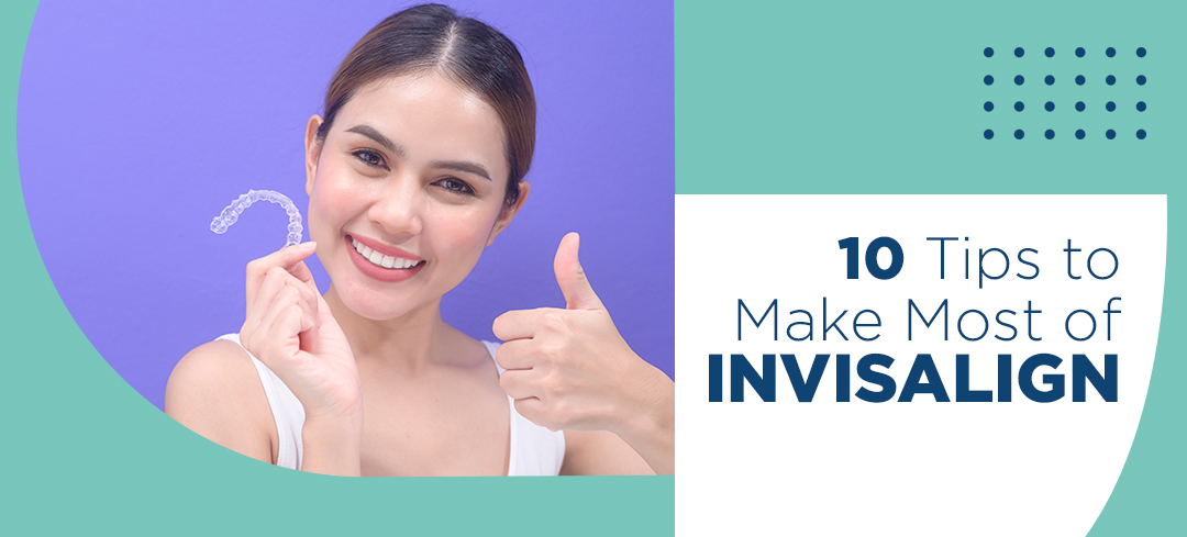 Tips to Make Most of Invisalign