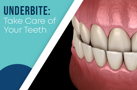 Underbite: Take Care of Your Teeth