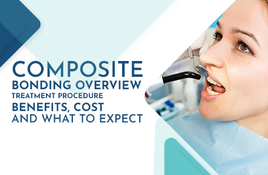 Composite Bonding Overview: Treatment Procedure, Benefits, Cost and What to Expect