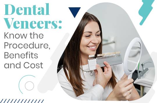 Dental Veneers: Know the Procedure, Benefits and Cost
