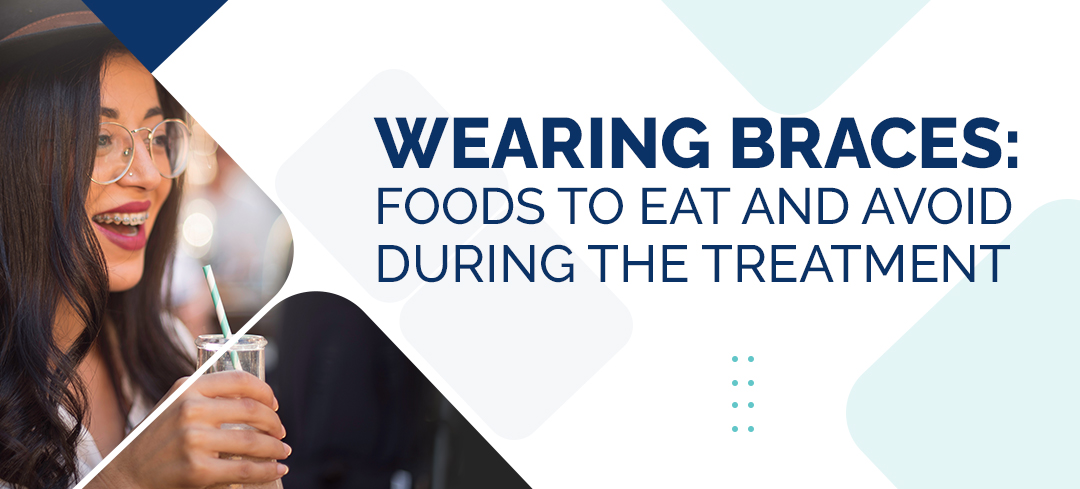 Wearing Braces: Foods to Eat and Avoid during the treatment
