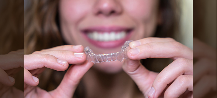 Exploring Invisalign SmartForce Attachments